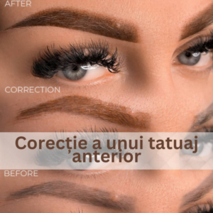 corectie a unui tatuaj anterior